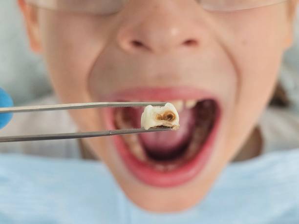 Best Pediatric Emergency Dentist in Chino Hills, CA